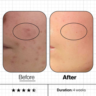 Advanced Nutrition Programme : Clear Skin Biome. 60 Capsules